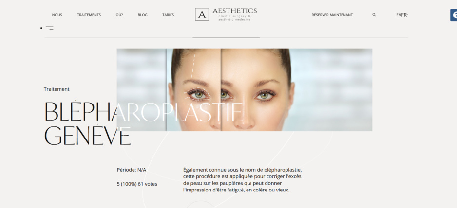 Blépharoplastie Genève, questions et réponses utiles Blépharoplastie Genève, questions et réponses utiles